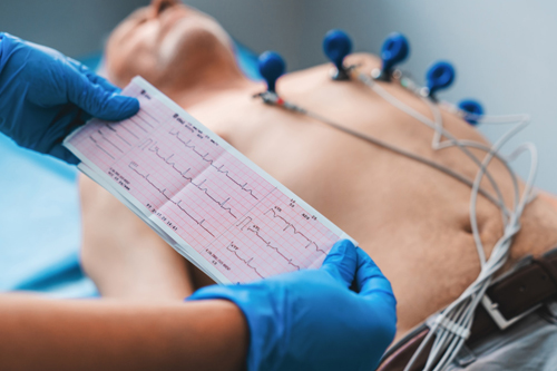 ECG Service